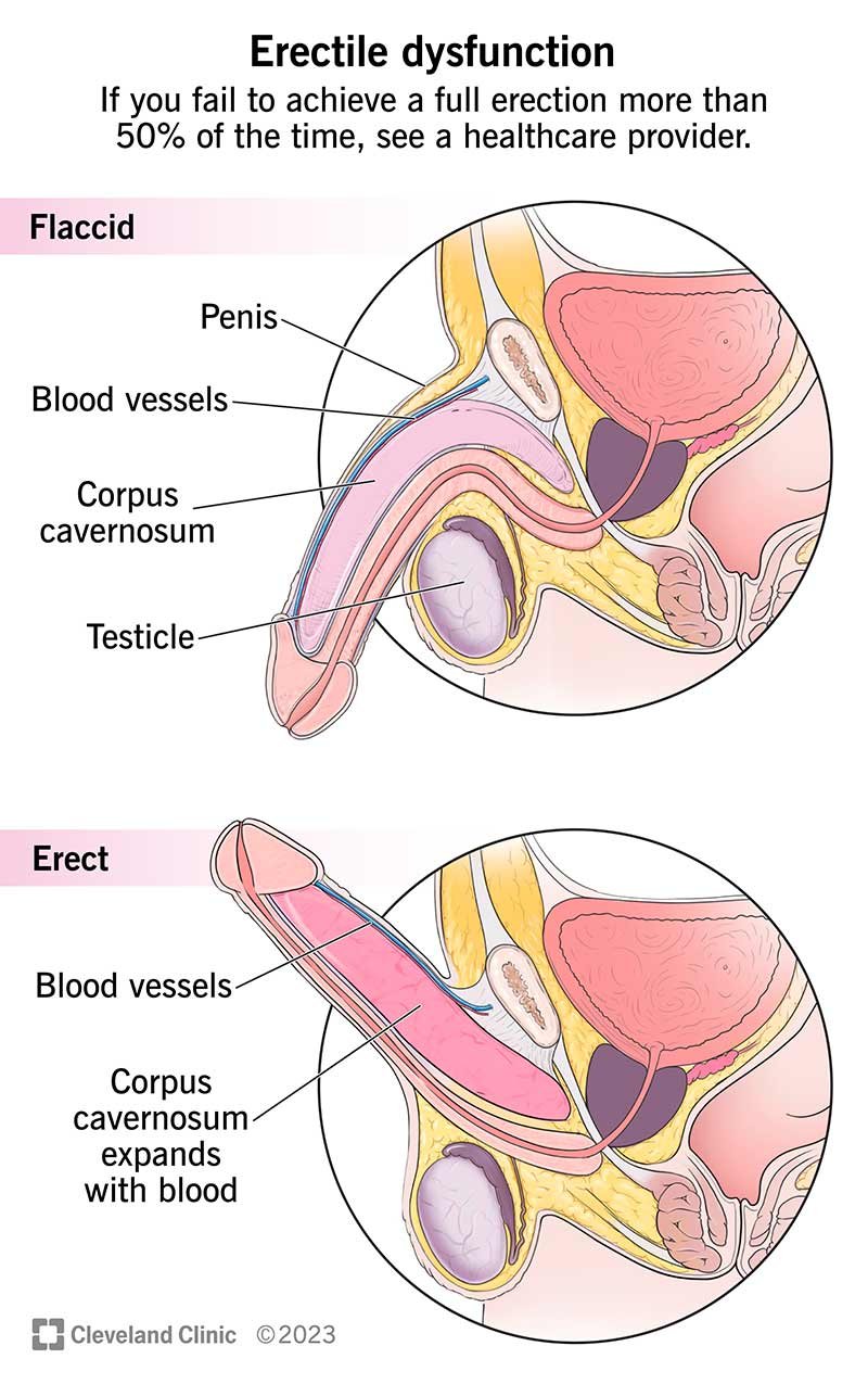 When to see a doctor for ED